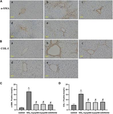 Cannabidiol alleviates carbon tetrachloride-induced liver fibrosis in mice by regulating NF-κB and PPAR-α pathways